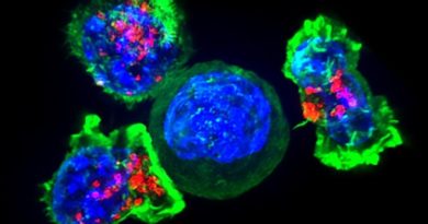 Тело наносит ответный удар: что такое иммунотерапия рака?