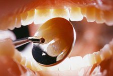 Английские ученые изобрели способ выращивания зубов