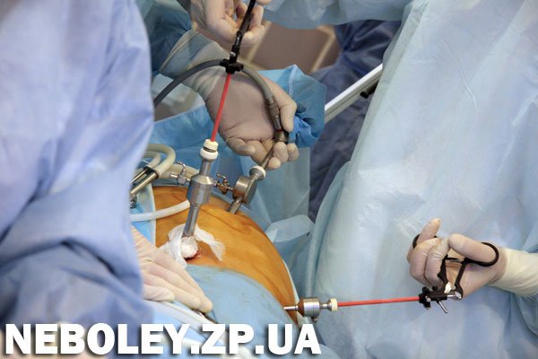 В Запорожье прошел всеукраинский мастер-класс по лапароскопической хирургии