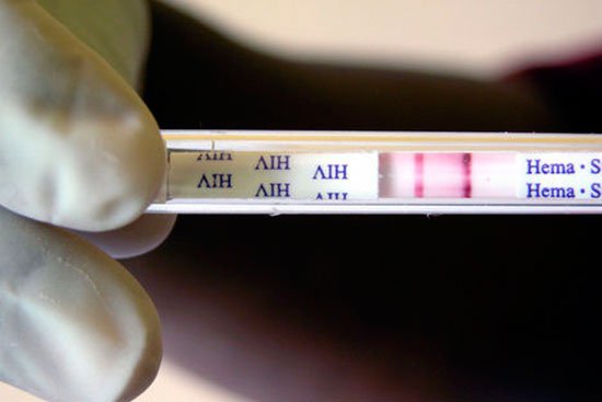 В ноябре в Запорожье пройдет европейская неделя тестирования на ВИЧ