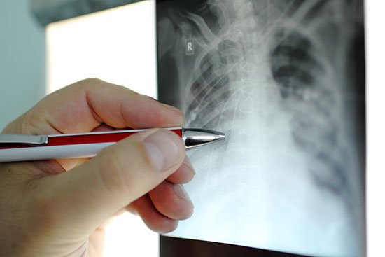 В Запорожье рентген-аппараты не справляются с нагрузкой