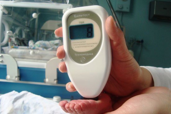 Три больницы Запорожской области получили современные приборы для измерения билирубина
