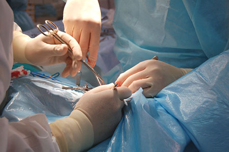 Хирургическое лечение патологий сердца в Израиле
