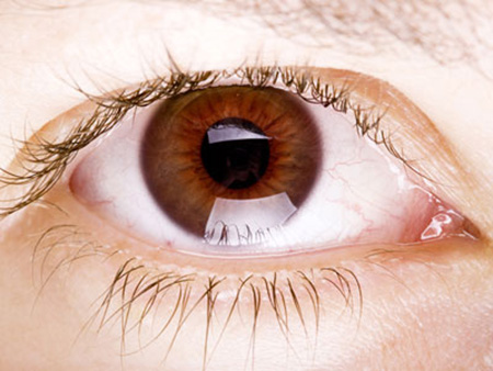 Почему нельзя медлить с лечением катаракты?